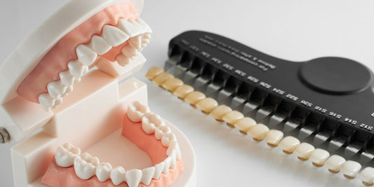 tooth colour gradient strip next to dental impression