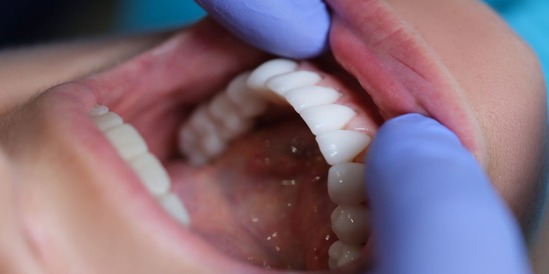 Does Poor Oral Health Affect General Health?