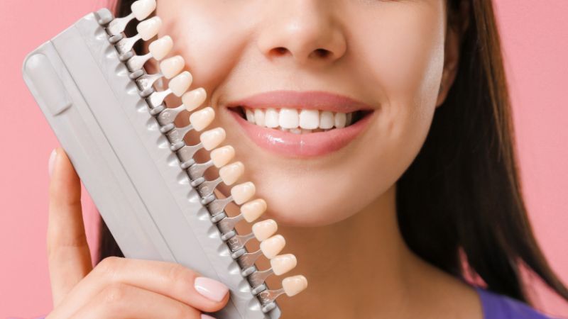 How To Prevent Teeth Staining